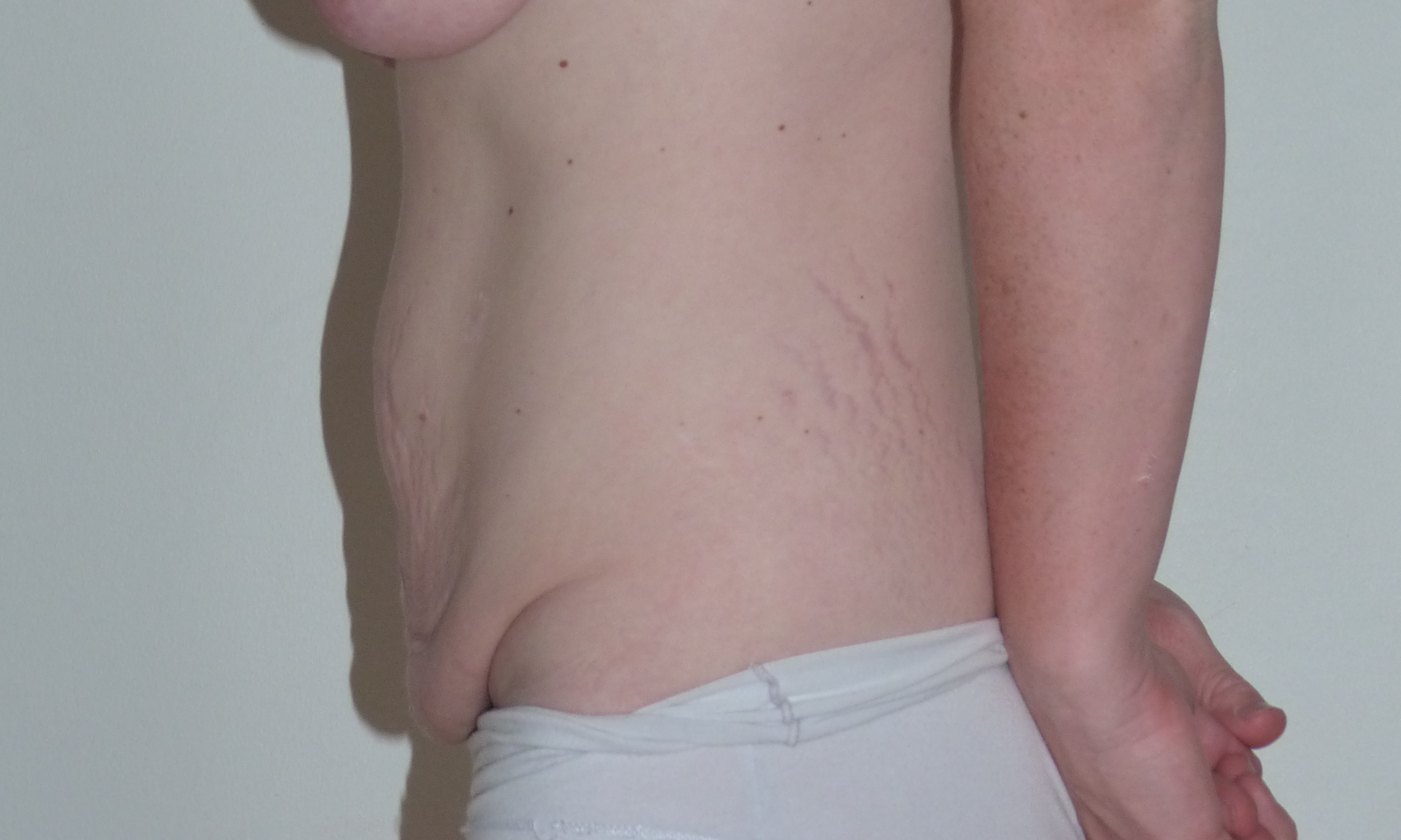 dålig i magen gravid dålig i magen gravid